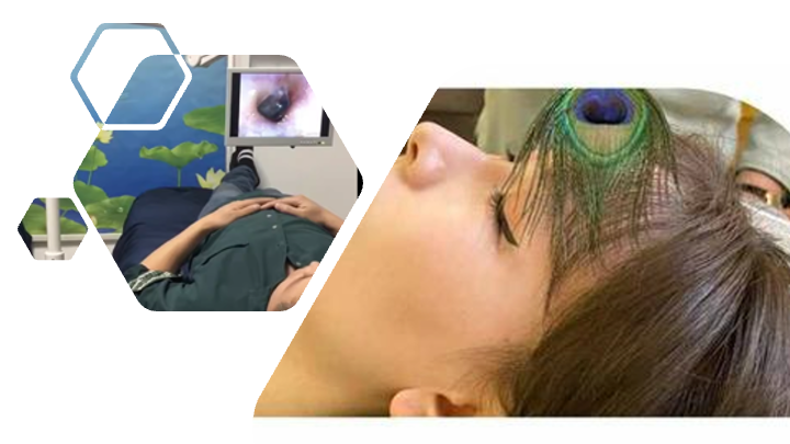 BZ03 : 可视古法采耳