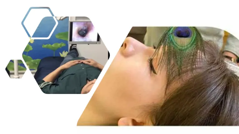 BZ03 : 可视古法采耳